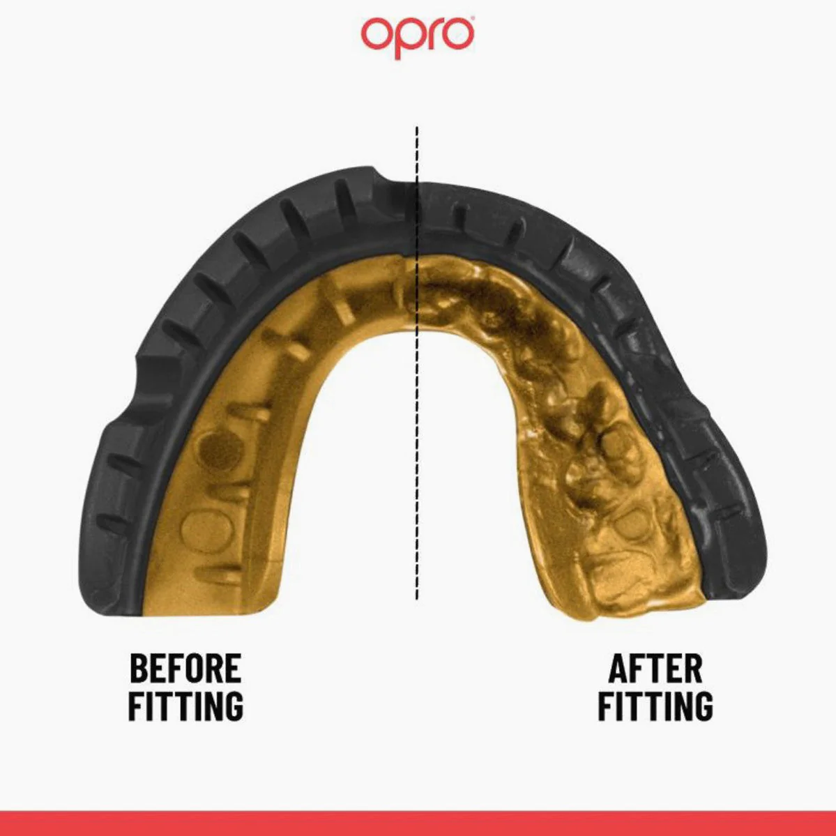 Protector bucal Opro Gold Self-Fit Braces para aparato  - Image 2