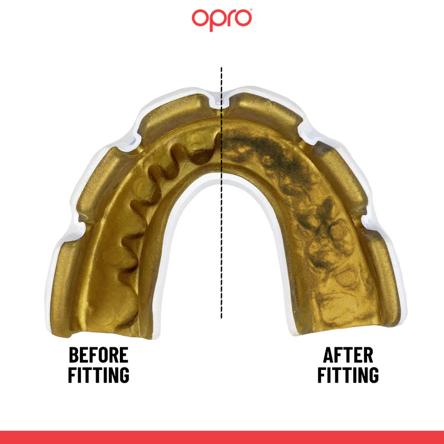 Protector bucal Opro Instant Custom-Fit para aparato Blanco-oro  - Image 2